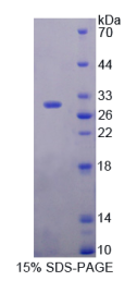 含DIX域蛋白1(DIXDC1)重组蛋白