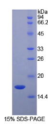 视黄醇结合蛋白5(RBP5)重组蛋白