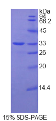 硒蛋白P1(SEPP1)重组蛋白