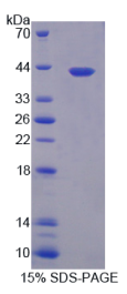 核因子κB(NFκB)重组蛋白