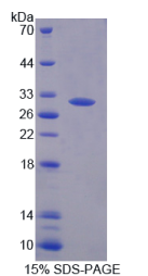 静止素Q6硫基氧化酶1(QSOX1)重组蛋白