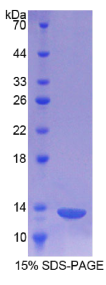 烟碱型胆碱受体α1(CHRNα1)重组蛋白