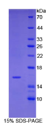 胰岛素样生长因子1(IGF1)重组蛋白