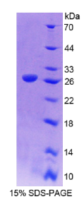 肌微管钙黏附蛋白(CDH15)重组蛋白