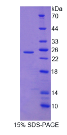 染色质域解旋酶DNA结合蛋白5(CHD5)重组蛋白