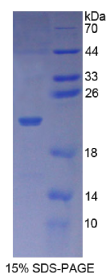 输出蛋白1(XPO1)重组蛋白