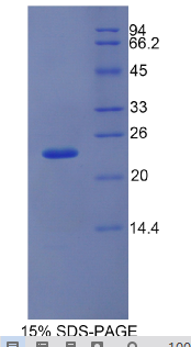 干扰素α5(IFNα5)重组蛋白