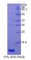 巨噬细胞炎性蛋白3α(MIP3α)重组蛋白