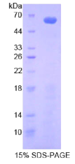 胰岛素样生长因子结合蛋白2(IGFBP2)重组蛋白