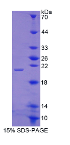 整合素β8(ITGβ8)重组蛋白