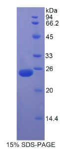 过氧化物酶体增殖物激活受体γ辅激活因子1α(PPARγC1α)重组蛋白