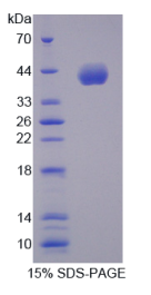 细胞周期素B2(CCNB2)重组蛋白