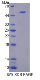 角蛋白25(KRT25)重组蛋白