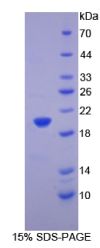 普列克底物蛋白同源物样域家族A成员2(PHLDA2)重组蛋白