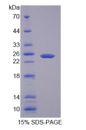 可溶性半乳糖凝集素3结合蛋白(LGALS3BP)重组蛋白