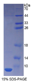 胸腺素β4(Tβ4)重组蛋白