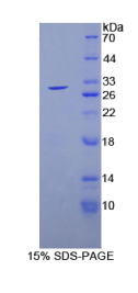 谷胱甘肽S转移酶θ2(GSTθ2)重组蛋白