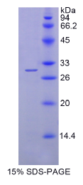 鞘氨醇1磷酸酯裂解酶1(SGPL1)重组蛋白
