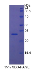 胰岛素样生长因子结合蛋白6(IGFBP6)重组蛋白