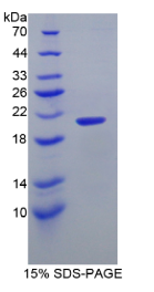 整合素α2B(ITGα2B)重组蛋白