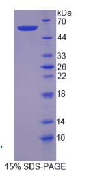 钙蛋白酶6(CAPN6)重组蛋白