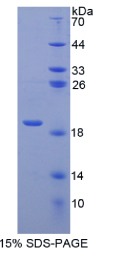 膜联蛋白A2(ANXA2)重组蛋白