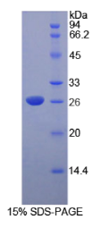 脱氧核糖核酸酶Ⅰ样2(DNASE1L2)重组蛋白