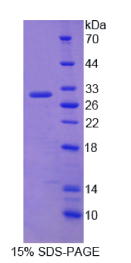 嗜铬蛋白B(CHGB)重组蛋白