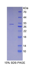 激肽释放酶11(KLK11)重组蛋白