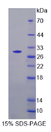 甘氨酸受体α2(GLRα2)重组蛋白