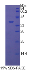 膜联蛋白A5(ANXA5)重组蛋白