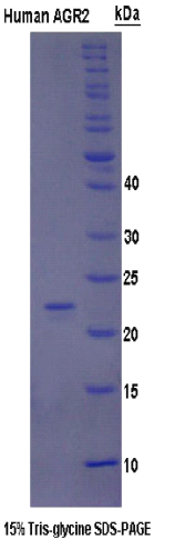 前梯度蛋白2(AGR2)重组蛋白