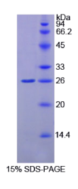 谷胱甘肽S转移酶κ1(GSTκ1)重组蛋白