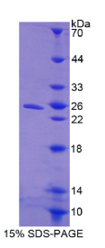 细胞因子诱导含SH2蛋白(CISH)重组蛋白