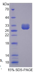 氯离子通道辅助蛋白1(CLCA1)重组蛋白