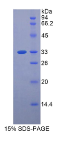 骨髓基质细胞抗原1(BST1)重组蛋白