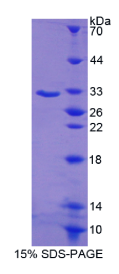 血清/糖皮质激素调节激酶1(SGK1)重组蛋白