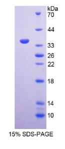 基质重塑关联蛋白5(MXRA5)重组蛋白