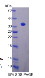 钙调磷酸酶结合蛋白1(CABIN1)重组蛋白