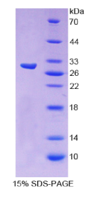 核基质蛋白4(NMP4)重组蛋白