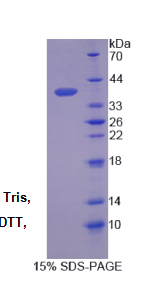 分泌球蛋白家族2A成员2(SCGB2A2)重组蛋白