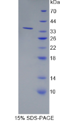 钙同线蛋白2(CLSTN2)重组蛋白