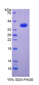 核因子κB2(NFκB2)重组蛋白