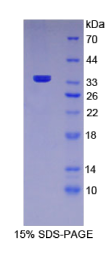 甘露糖受体C1(MRC1)重组蛋白