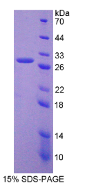 磷脂酰肌醇蛋白聚糖3(GPC3)重组蛋白