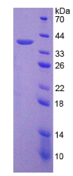 角蛋白18(KRT18)重组蛋白