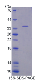 原肌球蛋白3(TPM3)重组蛋白