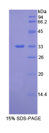 整合素β1(ITGβ1)重组蛋白