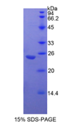 胰岛素样生长因子结合蛋白7(IGFBP7)重组蛋白