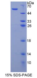 基质金属蛋白酶15(MMP15)重组蛋白